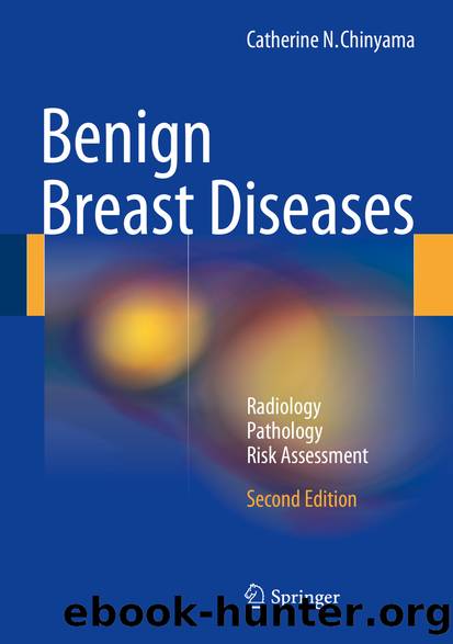 Benign Breast Diseases by Catherine N. Chinyama