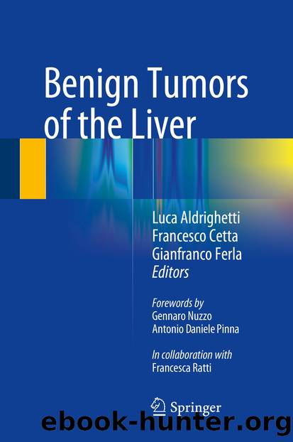 Benign Tumors of the Liver by Luca Aldrighetti Francesco Cetta & Gianfranco Ferla