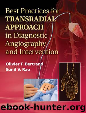 Best Practices for Transradial Approach in Diagnostic Angiography and Intervention by Bertrand Olivier & Rao Sunil
