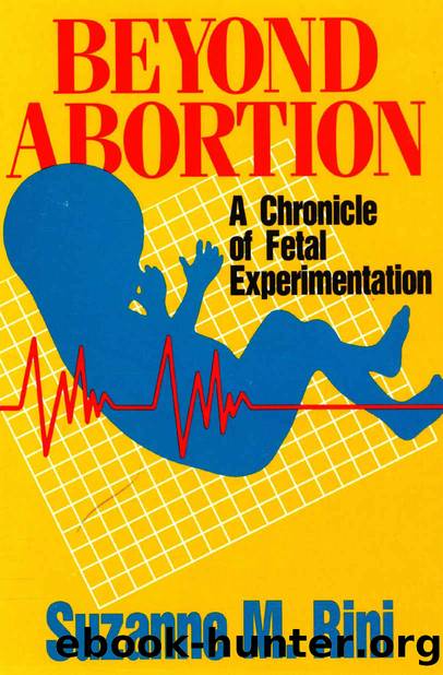Beyond Abortion by Rini Suzanne M
