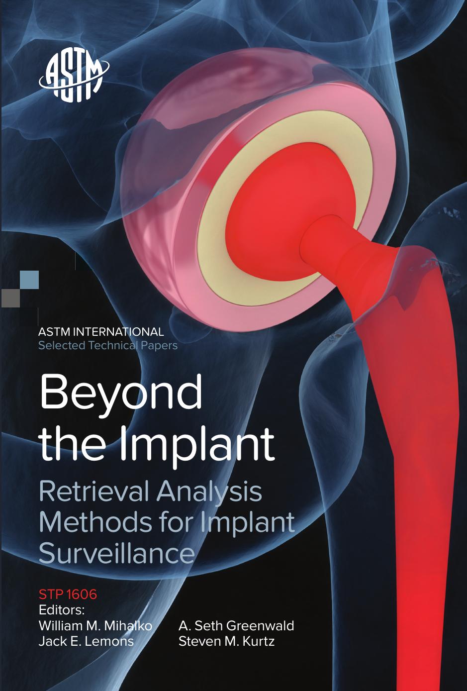 Beyond the Implant: Retrieval Analysis Methods for Implant Surveillance by Unknown