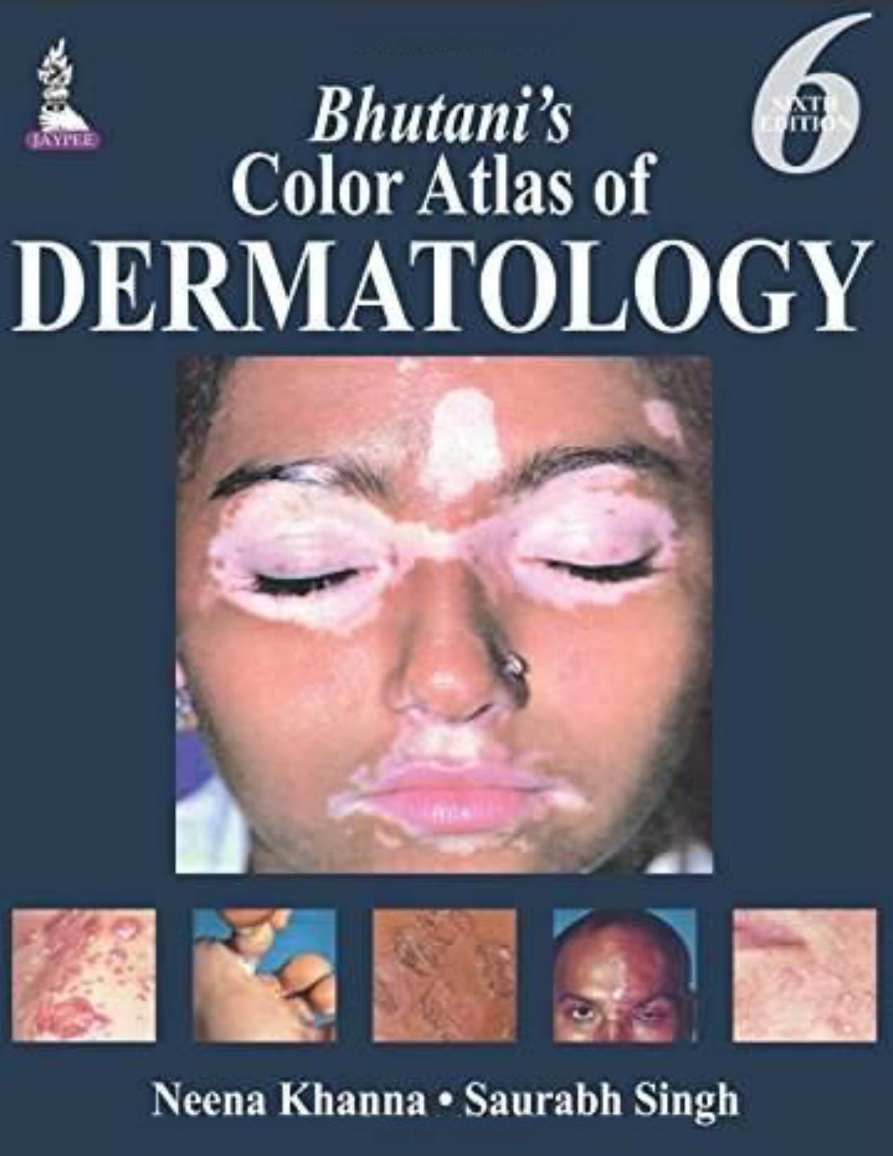 Bhutani's Color Atlas of Dermatology [Repost] by Neena Khanna