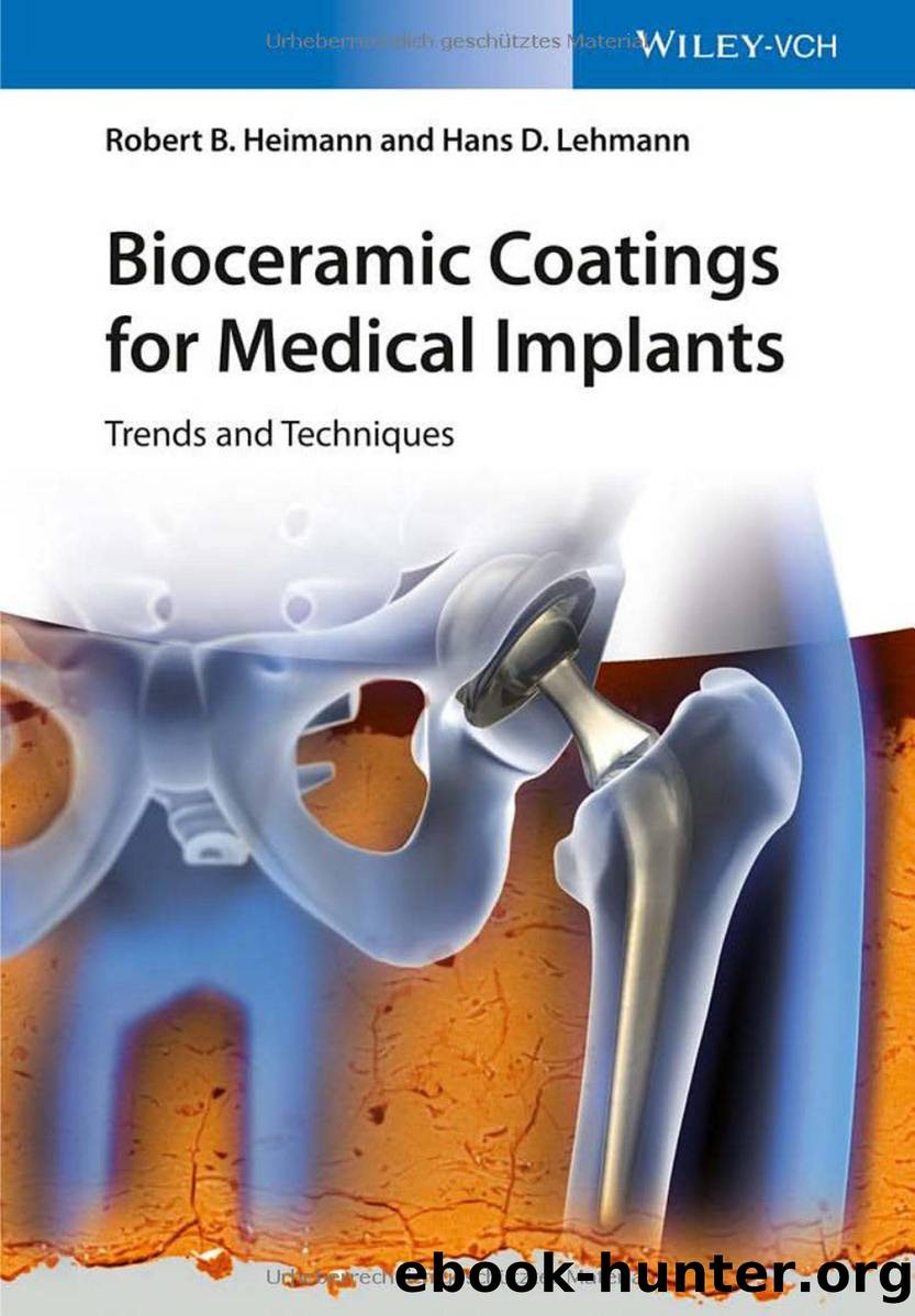 Bioceramic Coatings for Medical Implants by Trends & Techniques