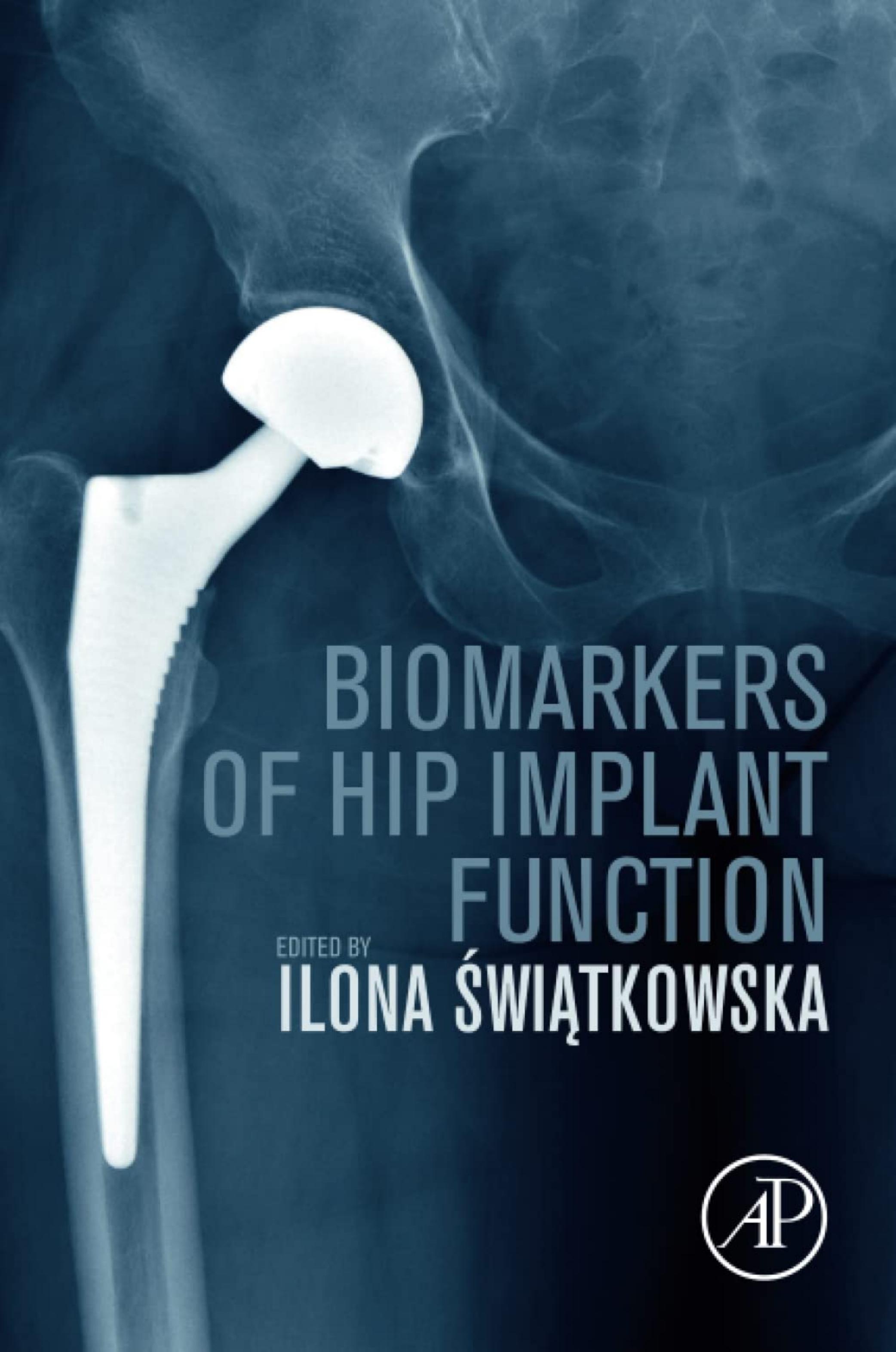 Biomarkers of Hip Implant Function: Diagnostic Modalities to Prevent Chronic Periprosthetic Joint Infection and Implant Failure by Ilona Świątkowska