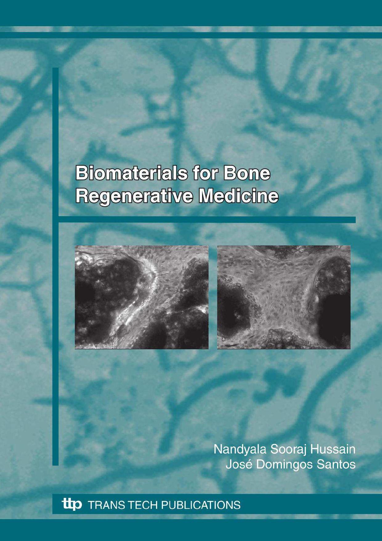 Biomaterials for Bone, Regenerative Medicine by Nandyala Sooraj Hussain; José D. Santos