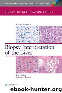 Biopsy Interpretation of the Liver (Biopsy Interpretation Series) by Torbenson Michael