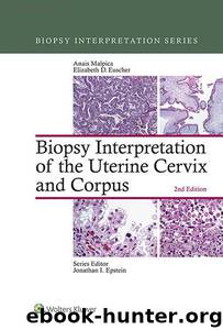 Biopsy Interpretation of the Uterine Cervix and Corpus by Malpica Anais & Euscher Elizabeth D