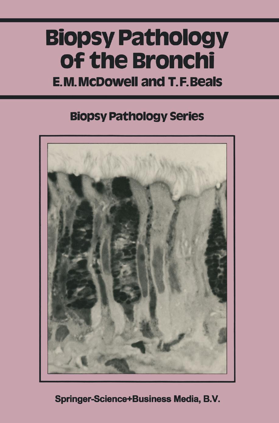 Biopsy Pathology of the Bronchi by Elizabeth M. McDowell B Vet Med PhD (Cantab) Theodore F. Beals MD (auth.)