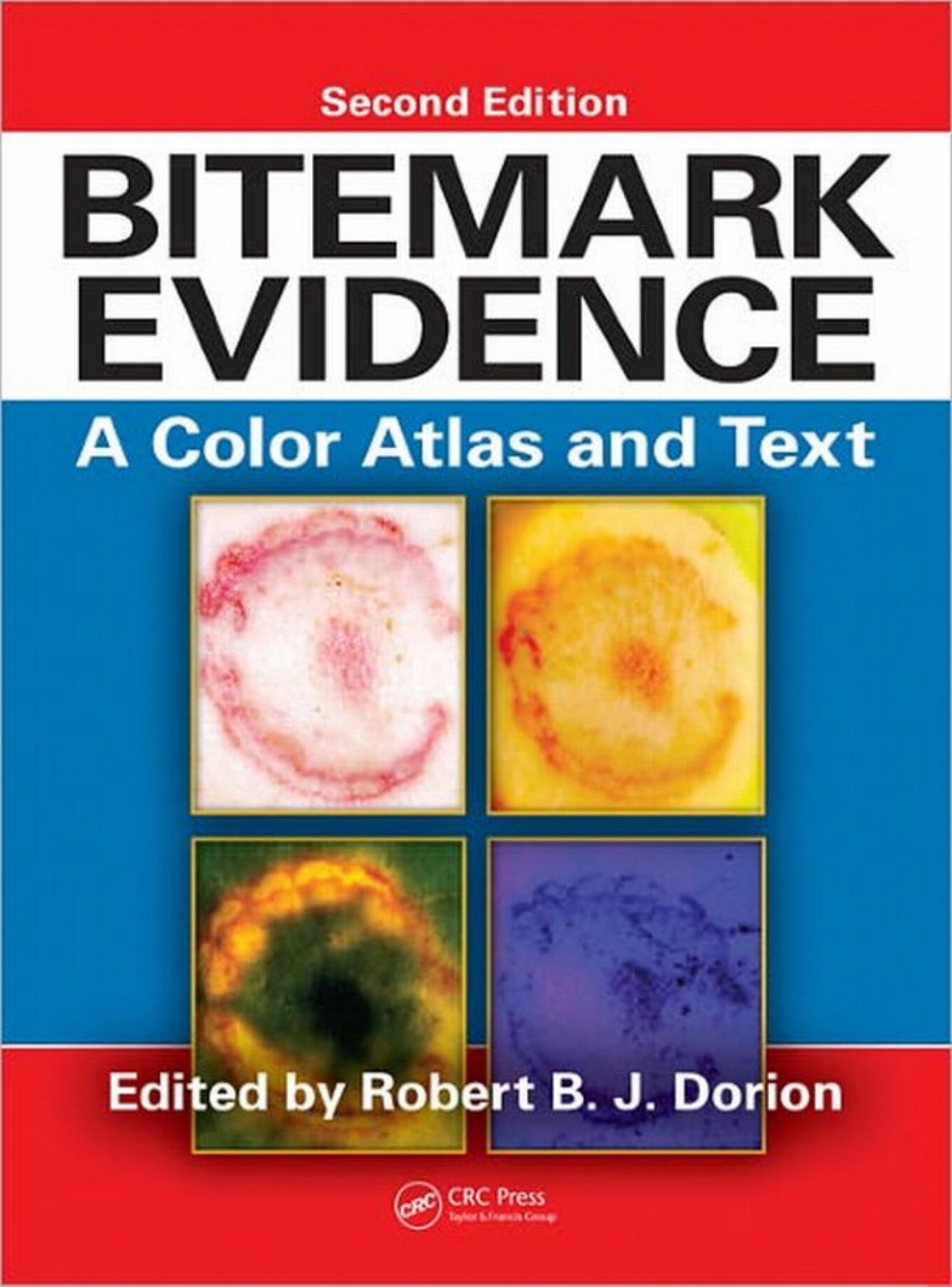 Bitemark Evidence: A Color Atlas and Text, 2nd Edition by Robert B.J. Dorion