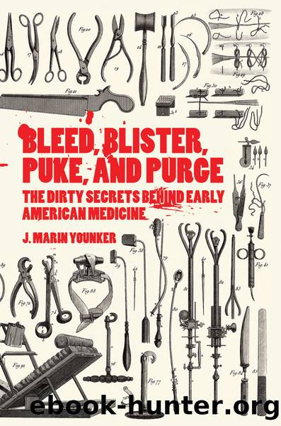 Bleed, Blister, Puke, and Purge by J. Marin Younker