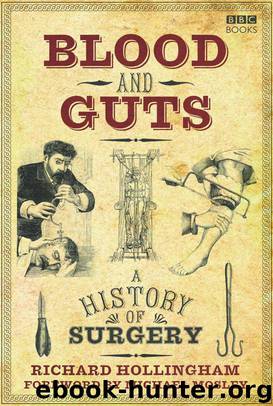 Blood & Guts: A History of Surgery by Hollingham Richard & Mosley Michael