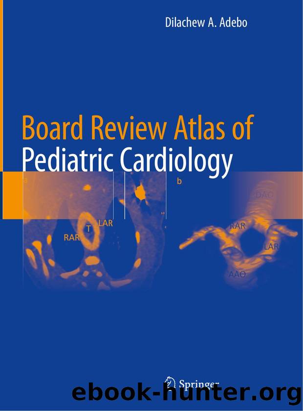 Board Review Atlas of Pediatric Cardiology by Unknown