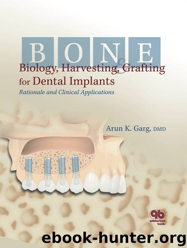 Bone Biology, Harvesting, Grafting For Dental Implants by Arun K. Garg