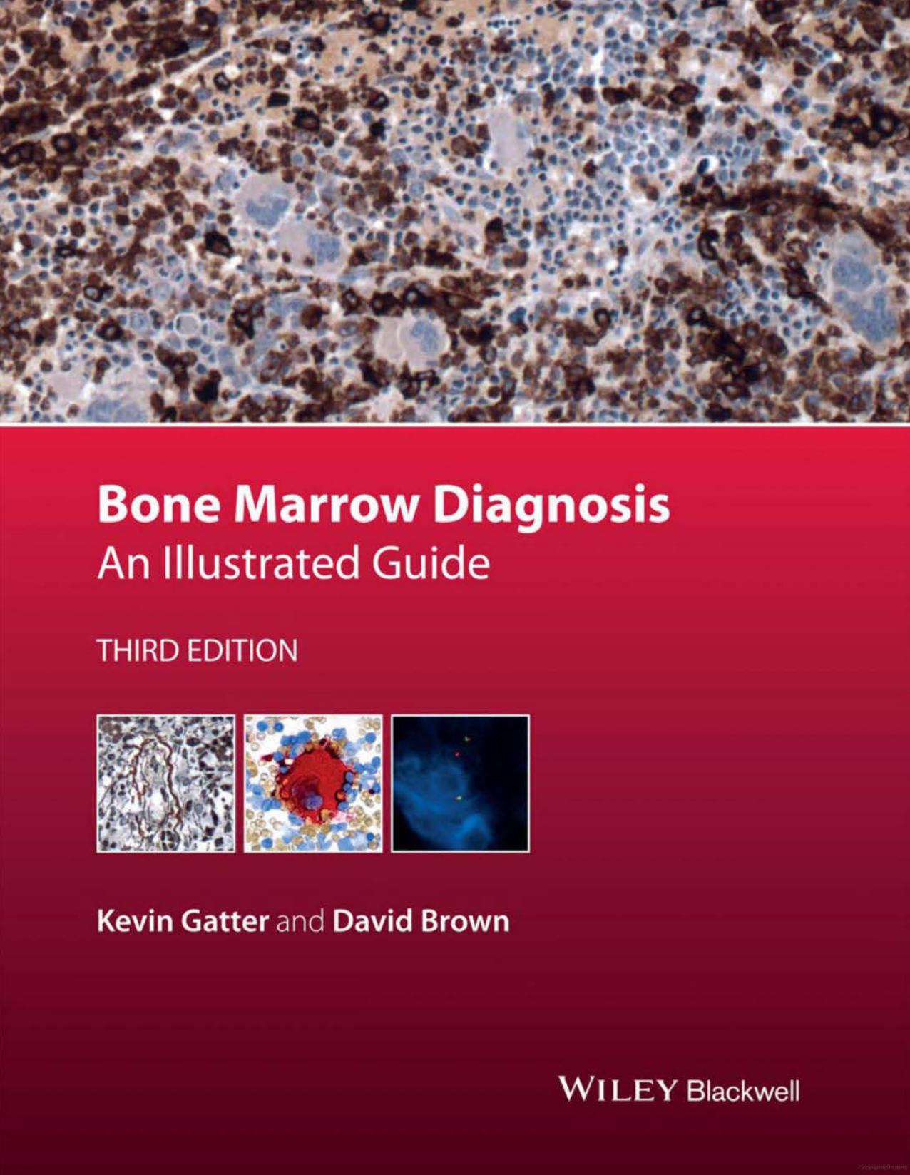 Bone Marrow Diagnosis: An Illustrated Guide by Kevin Gatter David Brown