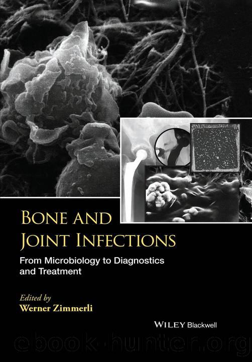 Bone and Joint Infections by W. Zimmerli