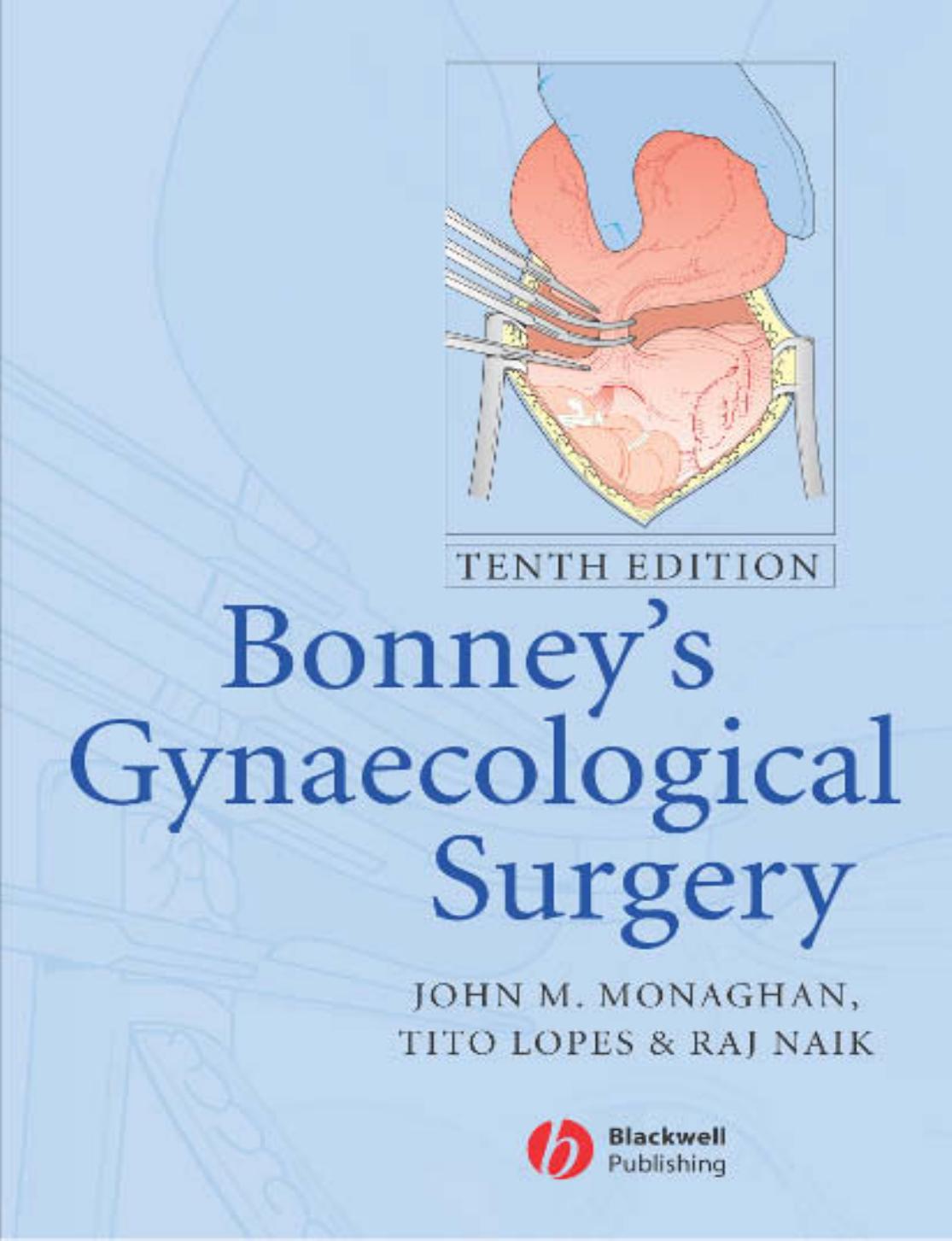 Bonney’s Gynaecological Surgery by Mauricio de Maio Berthold Rzany