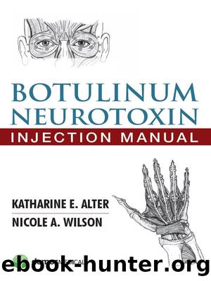 Botulinum Neurotoxin Injection Manual by Katharine E. Alter MD & Nicole A. Wilson MD PhD