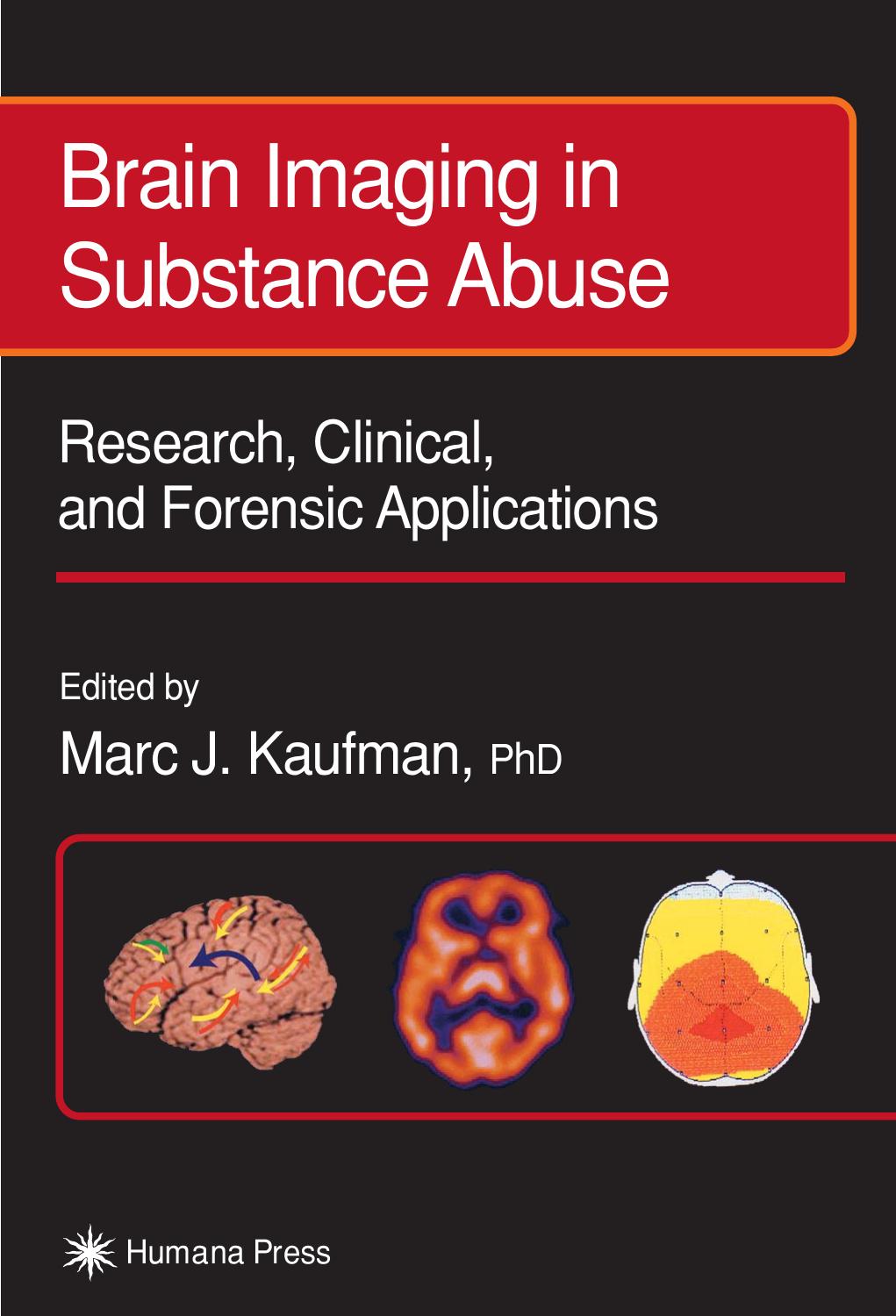 Brain Imaging in Substance Abuse. Research, Clinical and Forensic Applns by Marc J. Kaufman