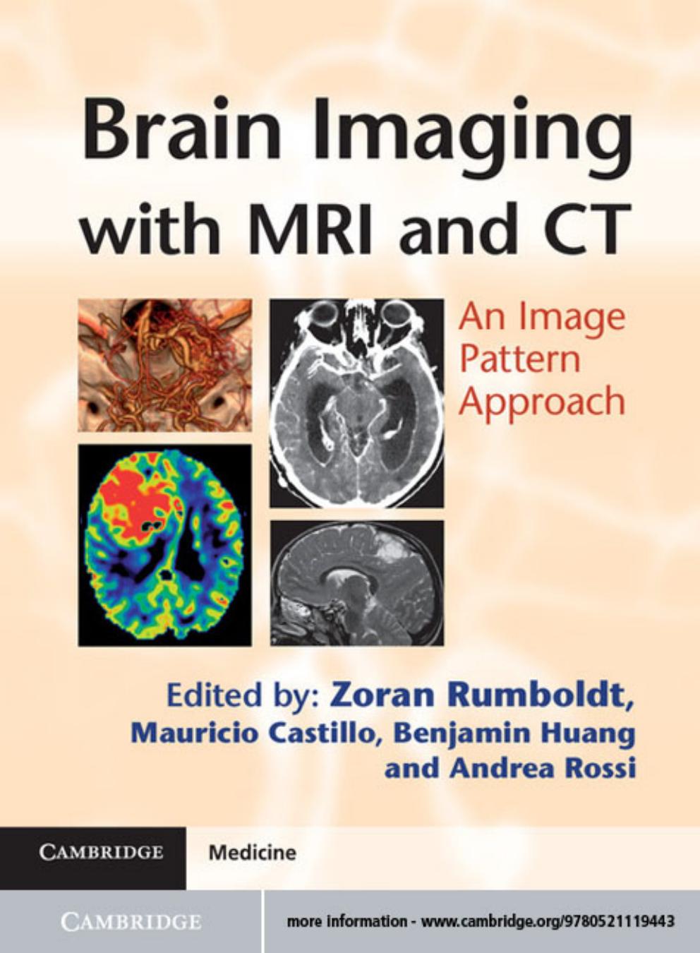 Brain Imaging with MRI and CT: An Image Pattern Approach by Zoran Rumboldt et al. (eds.)
