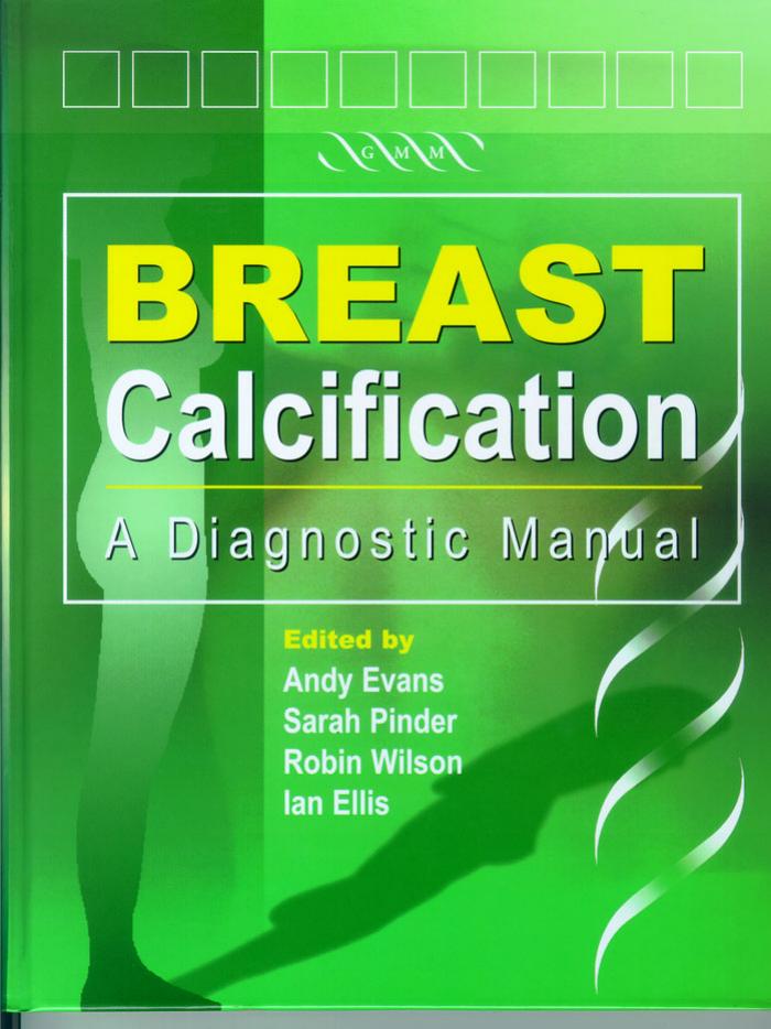 Breast Calcification- A Diagnostic Manual by Andy Evans Ian Ellis Sarah Pinder Robin Wilson