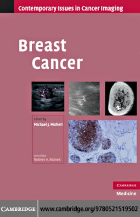 Breast Cancer (Contemporary Issues in Cancer Imaging) by Michael J. Michell
