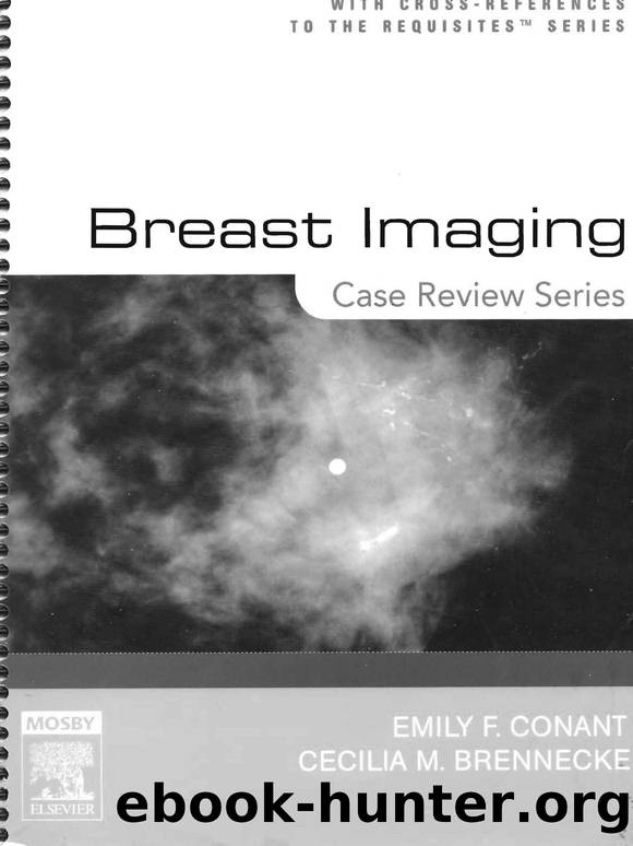 Breast Imaging - Case Review Series by E. Conant C. Brennecke (Mosby) WW