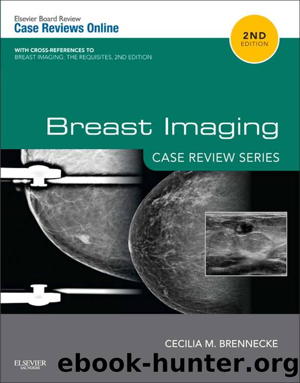 Breast Imaging: Case Review Series by Brennecke Cecilia M