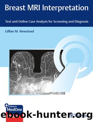 Breast MRI Interpretation: Text and Online Case Analysis for Screening and Diagnosis by Gillian M. Newstead