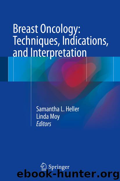 Breast Oncology: Techniques, Indications, and Interpretation by Samantha L. Heller & Linda Moy
