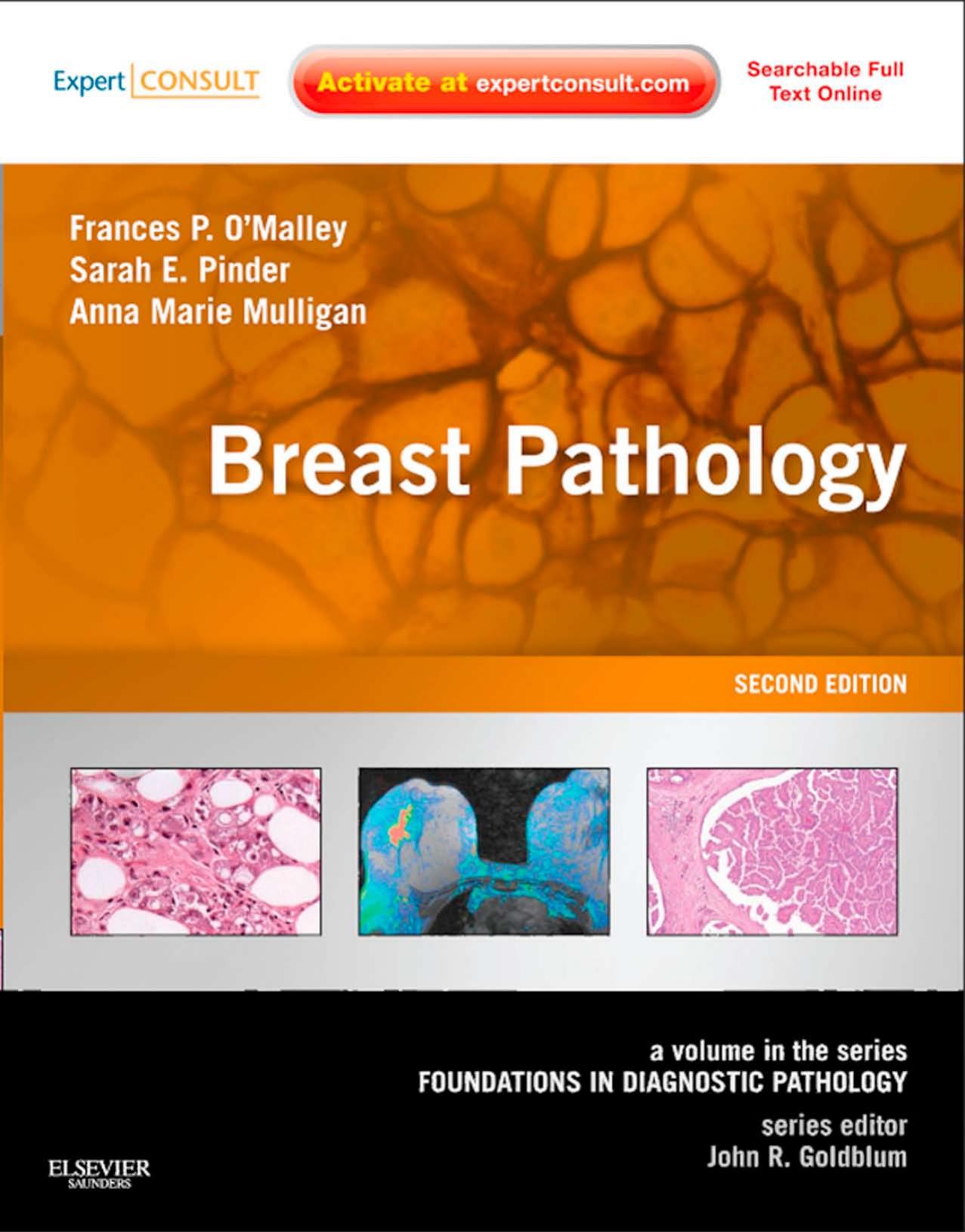 Breast Pathology: A Volume in the Series: Foundations in Diagnostic Pathology (Expert Consult - Online and Print), 2e by Frances P. O'Malley Sarah E. Pinder Anna Marie Mulligan