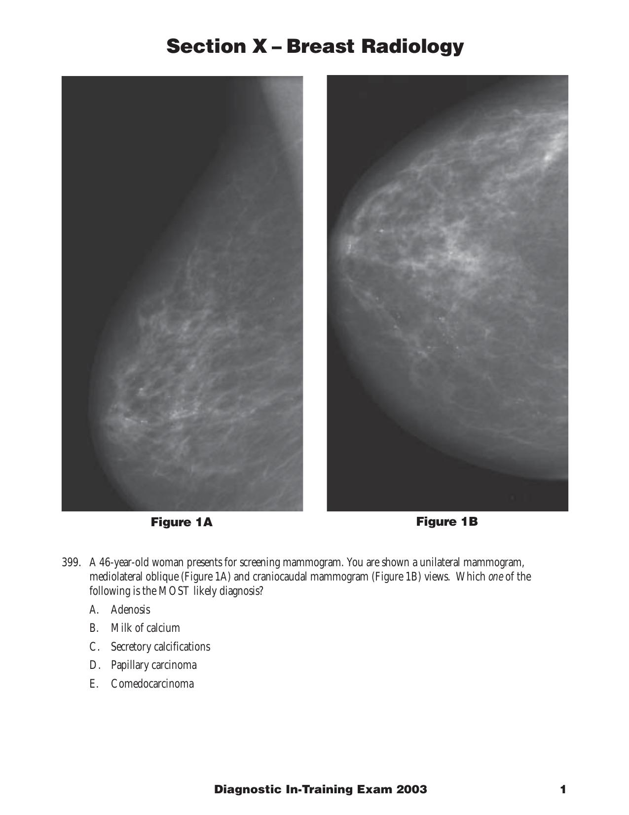 Breast by keiths