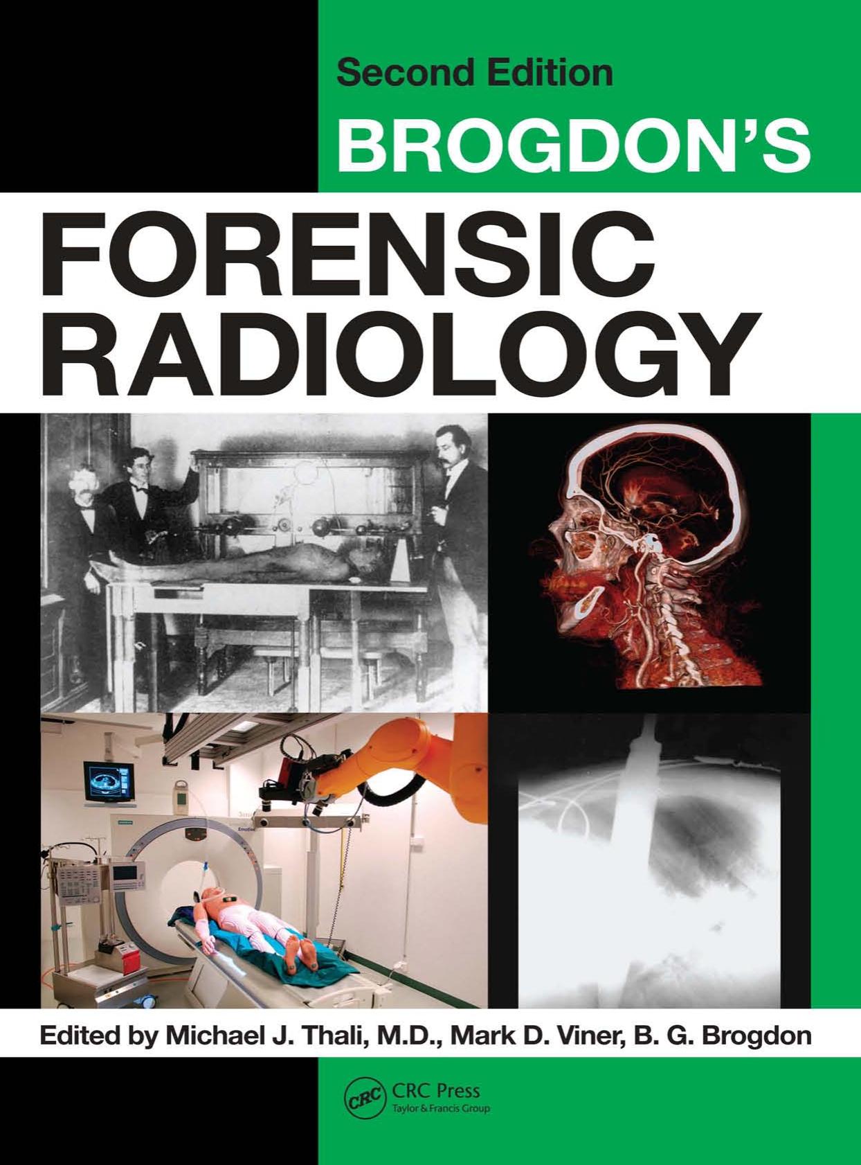 Brogdon's Forensic Radiology, Second Edition by Michael J. Thali Mark D. Viner B.G. Brogdon