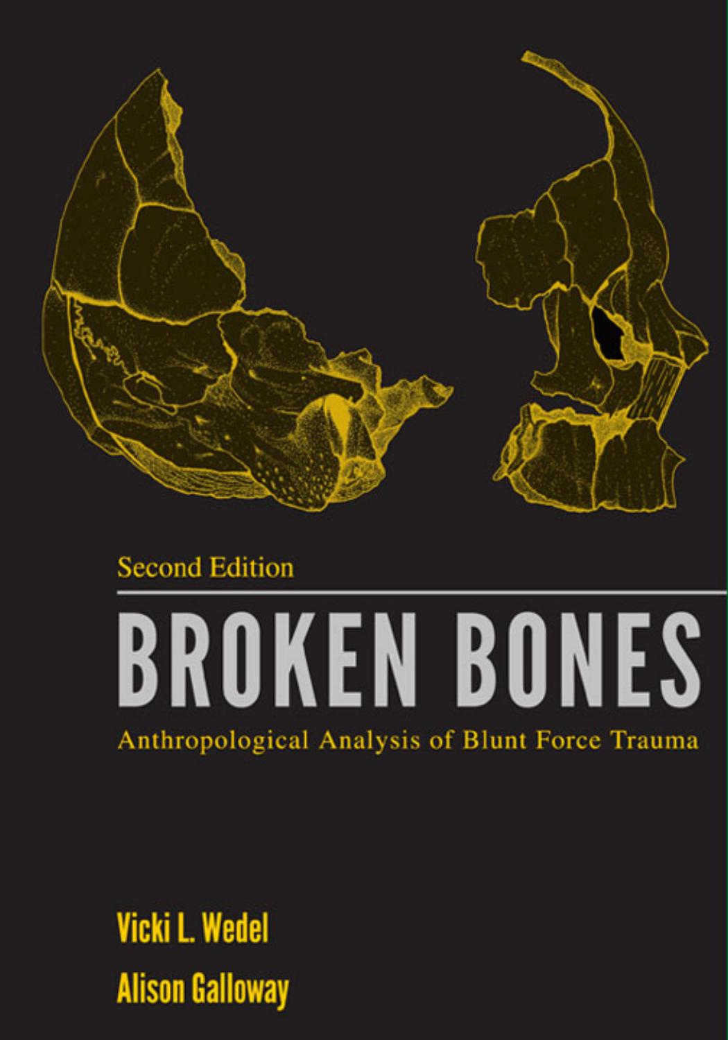 Broken Bones: Anthropological Analysis of Blunt Force Trauma by Wedel Vicki L. & Galloway Alison