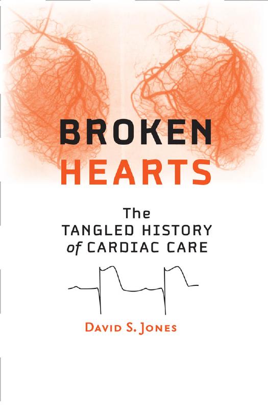 Broken Hearts: The Tangled History of Cardiac Care by David S. Jones