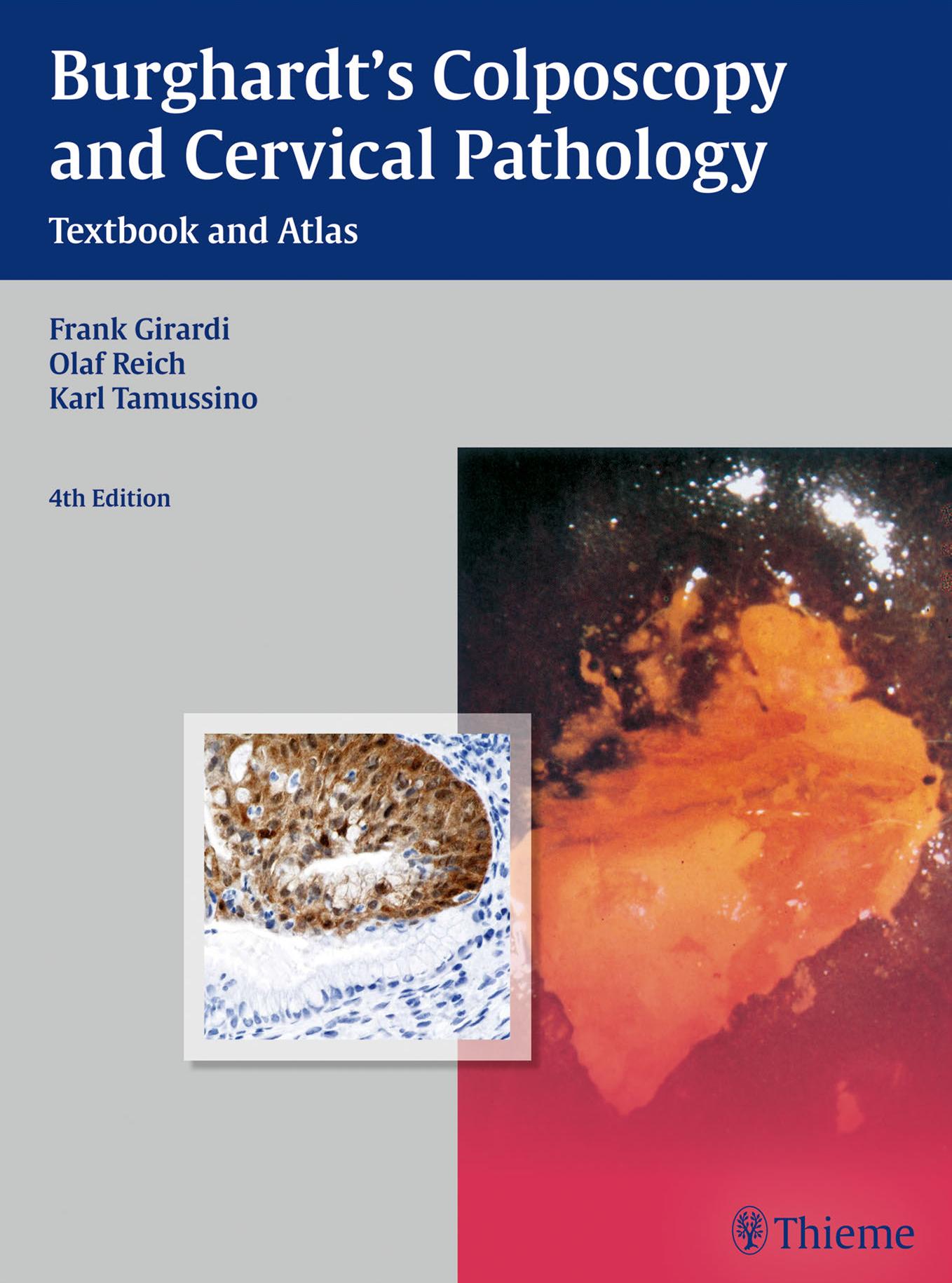 Burghardt's Colposcopy and Cervical Pathology: Textbook and Atlas by Frank Girardi Olaf Reich Karl Tamussino