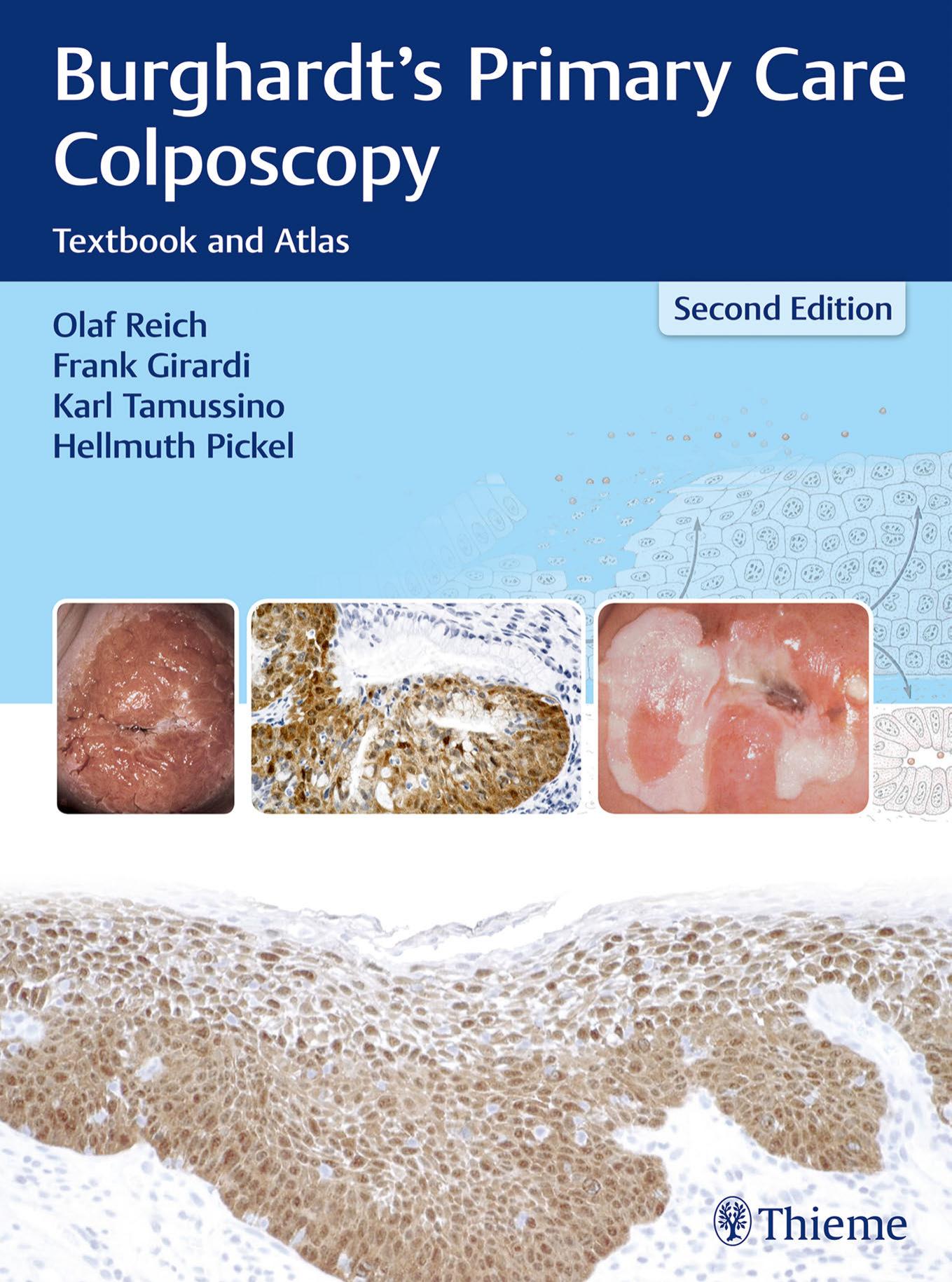 Burghardt's Primary Care Colposcopy: Textbook and Atlas, 2 edition by Olaf Reich and Frank Girardi