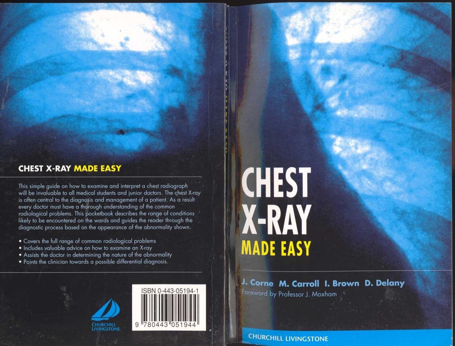 CHEST X-RAY MADE EASY by Unknown
