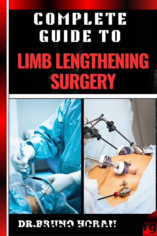 COMPLETE GUIDE TO LIMB LENGTHENING SURGERY: Essential Handbook To Modern Techniques, Recovery, And Best Practices For Optimal Results by HORAN DR. BRUNO