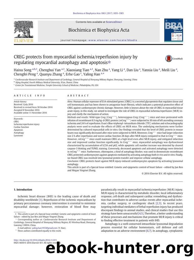 CREG protects from myocardial ischemiareperfusion injury by regulating myocardial autophagy and apoptosis by unknow
