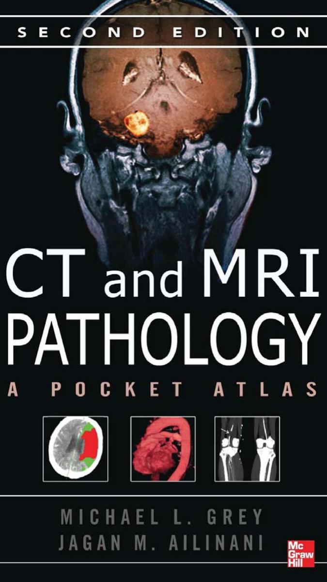 CT & MRI Pathology: A Pocket Atlas, Second Edition (repost) by Unknow
