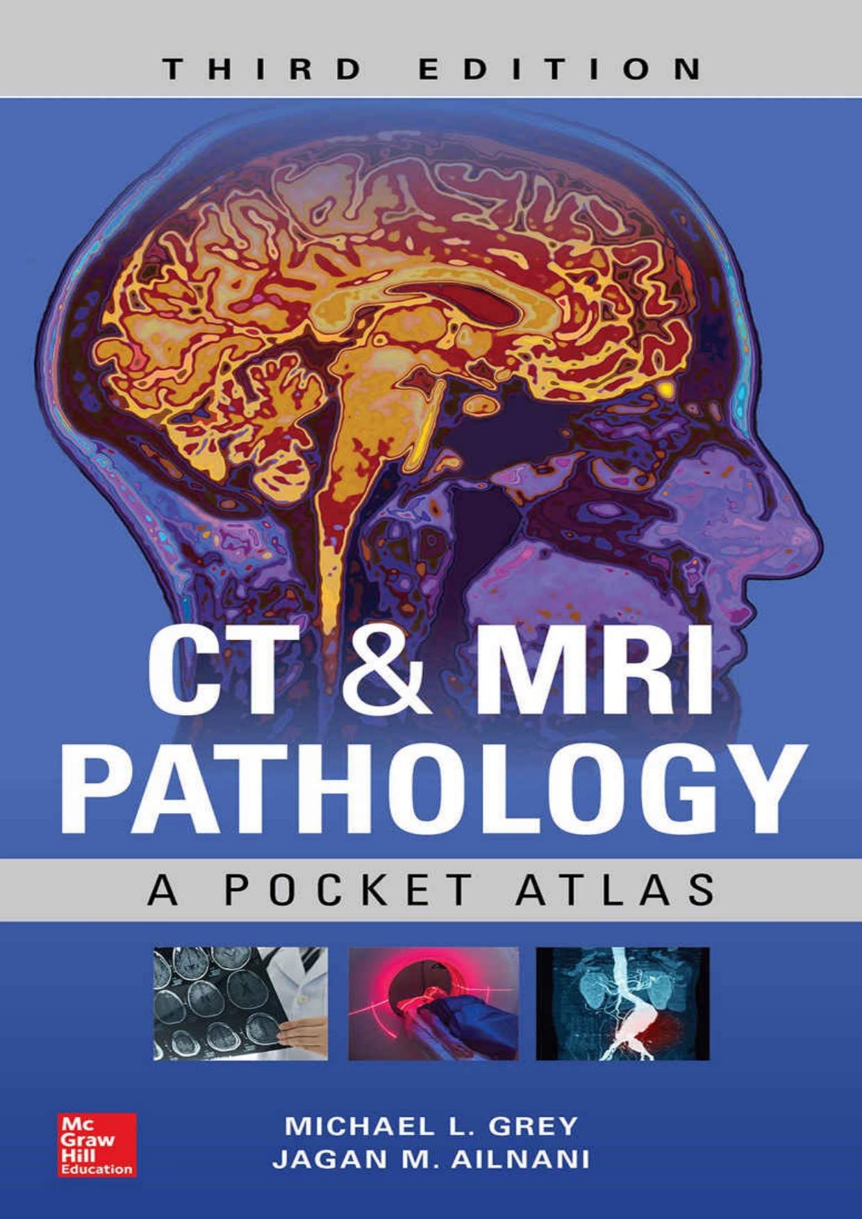 CT & MRI Pathology: A Pocket Atlas, Third Edition by Michael L Grey Jagan Mohan Ailinani