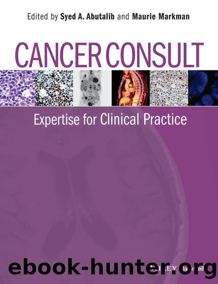 Cancer Consult by Syed A. Abutalib & Maurie Markman