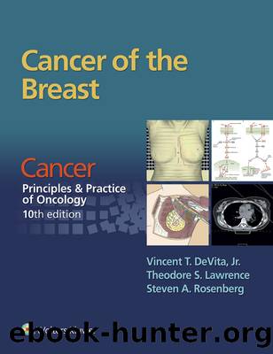 Cancer of the Breast by DeVita Vincent T.;Lawrence Theodore S.;Rosenberg Steven A.;