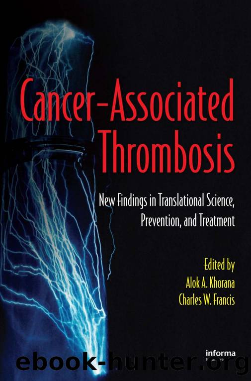 Cancer-associated Thrombosis : New Findings in Translational Science, Prevention, and Treatment by technet
