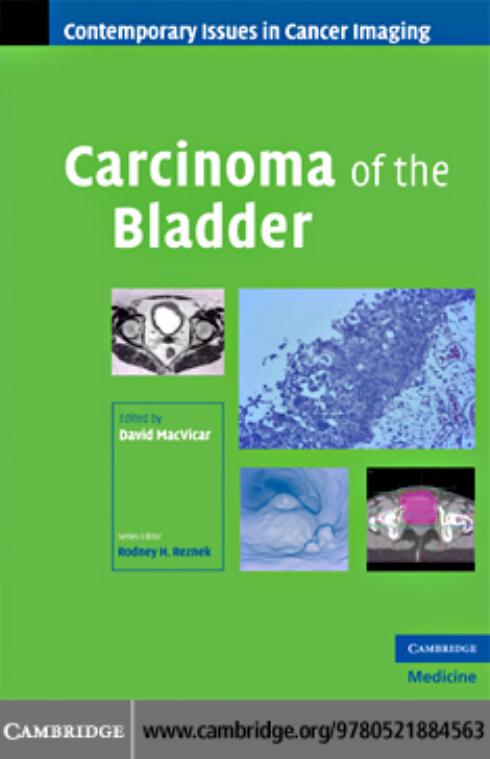 Carcinoma of the Bladder (Contemporary Issues in Cancer Imaging) by David MacVicar