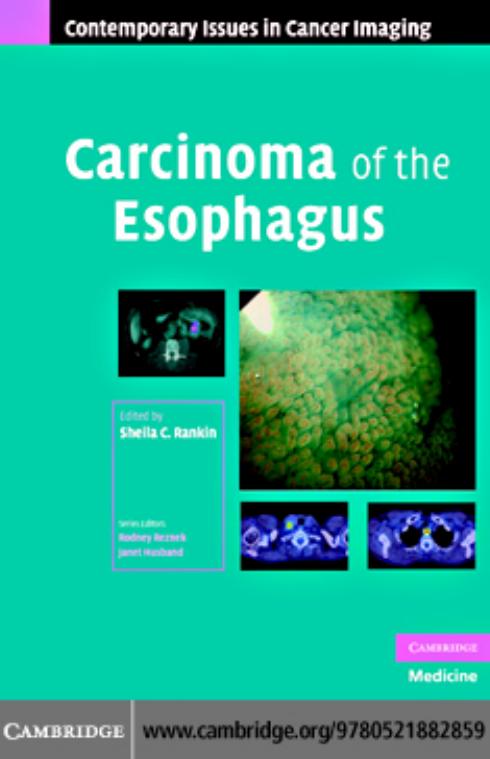 Carcinoma of the Esophagus (Contemporary Issues in Cancer Imaging) by Sheila C. Rankin