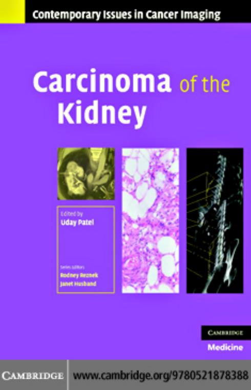 Carcinoma of the Kidney (Contemporary Issues in Cancer Imaging) by Uday Patel