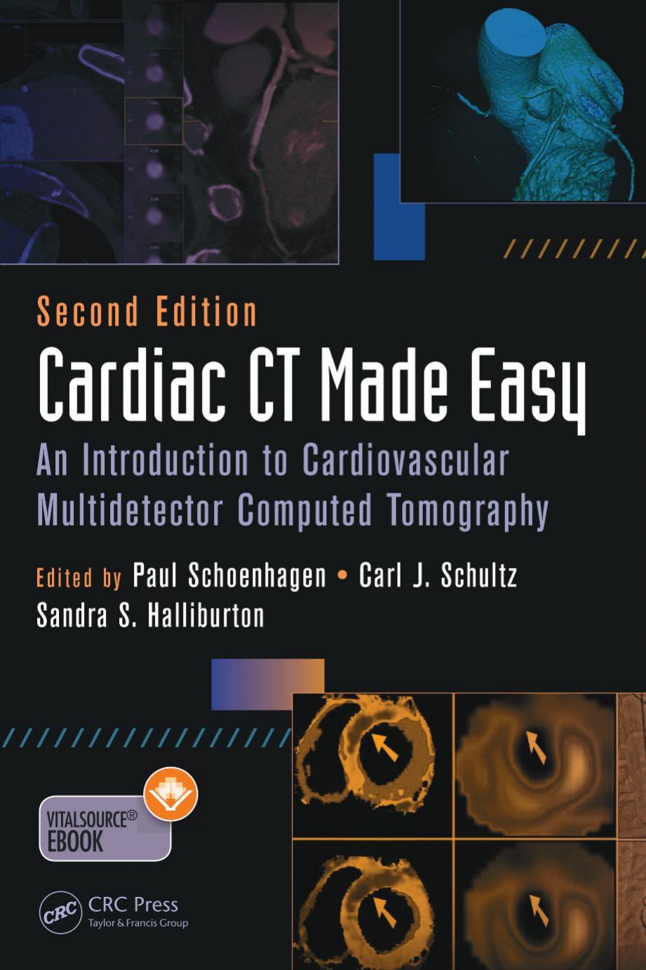 Cardiac CT Made Easy: An Introduction to Cardiovascular Multidetector Computed Tomography, Second Edition by Unknow