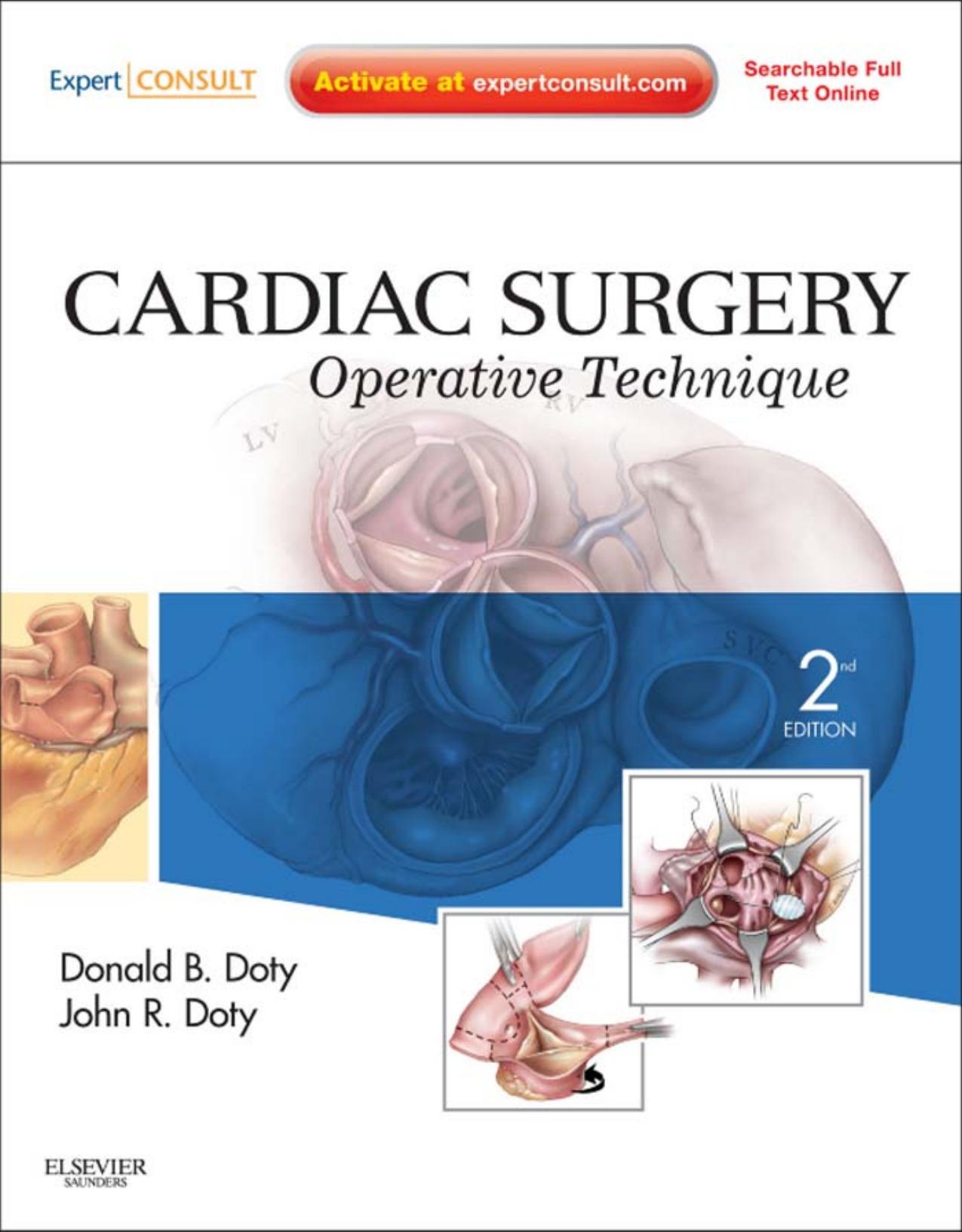 Cardiac Surgery: Operative Technique by Donald B. Doty MD John R. Doty MD