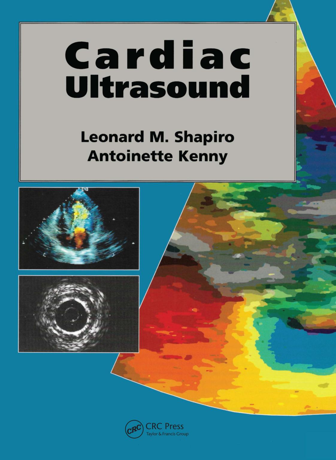 Cardiac Ultrasound by Antoinette Kenny Kenny Antoinette Leonard M. Shapiro